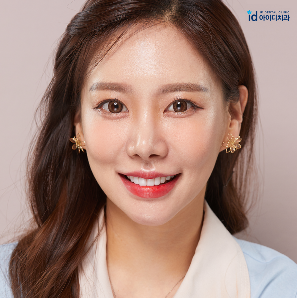 치아교정후기 알아볼 때 봐야 할 키포인트! (feat.아이디치과) 관련 이미지 1