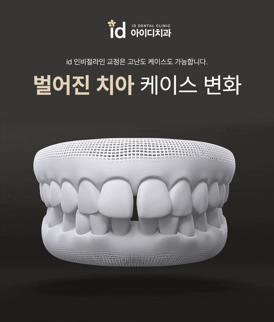 인비절라인가격 선택하기 전 알아두면 좋은 내용! 관련 이미지 15