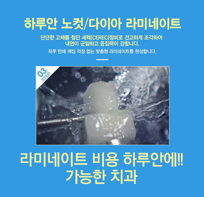 라미네이트 비용 싸다구!! 관련 이미지 5