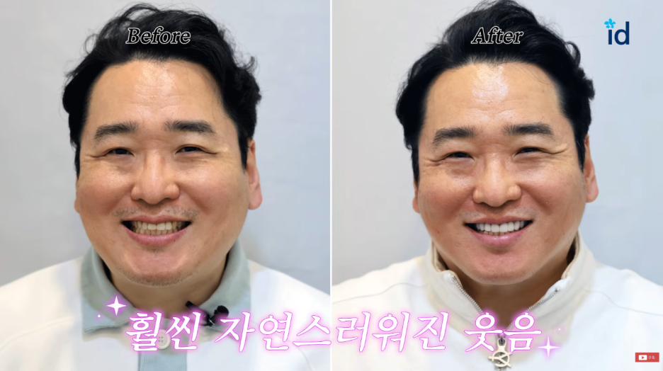 무삭제라미네이트 나에게 잘 어울리는 자연스러움 관련 이미지 11