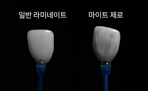 라미네이트 치료를 위한 정보 관련 이미지 6