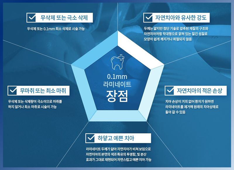 영점일 라미네이트 비용 만큼 중요한건 치아 삭제량! 관련 이미지 3