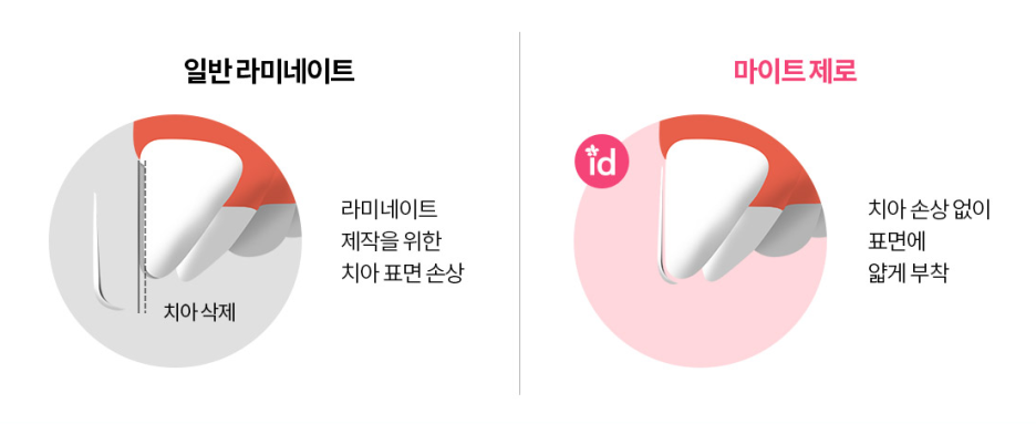 라미네이트 치료를 위한 정보 관련 이미지 11