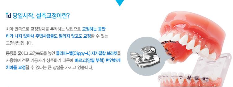 티안나는교정 안쪽으로 꼬옥 숨겨서 남모르게 관련 이미지 3