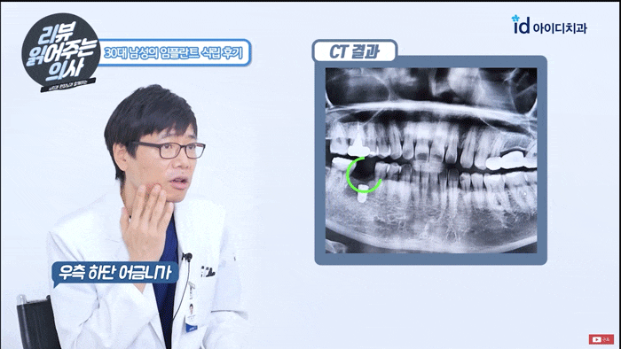 How Is Implant Surgery Performed? image 6