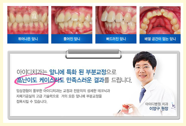 앞니교정후기 어떤 앞니고민도 다양하게 해결 관련 이미지 4
