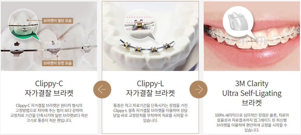 앞니 부분교정, 간단하게 꼭 필요한 부위만 관련 이미지 4