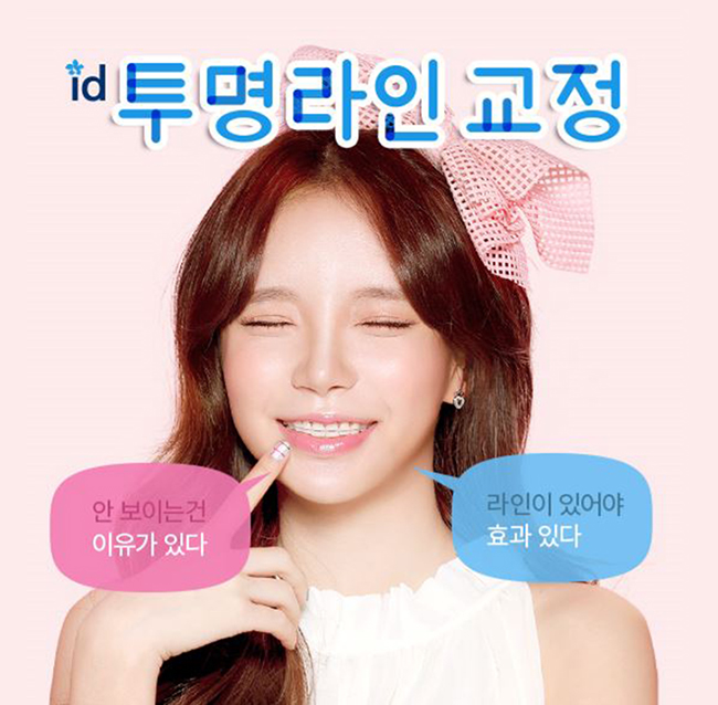 치아투명교정 마무리 확실한곳 있으니 투명교정효과 못봤다면 주목! 관련 이미지 2