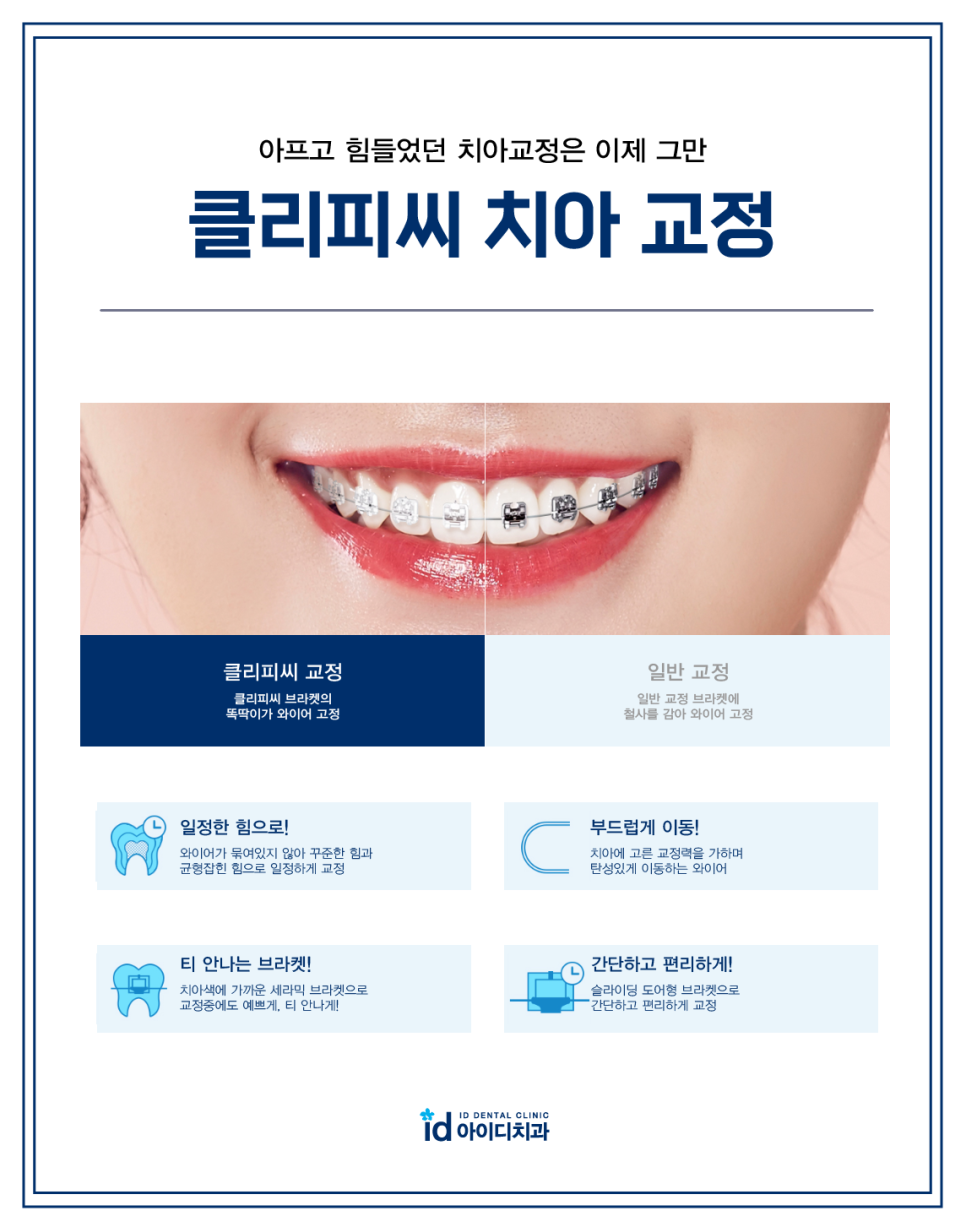치아교정 장치 선택이 어렵다면? 관련 이미지 6