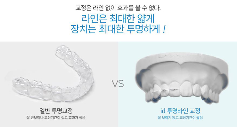 투명교정기 효과가 걱정된다면? 아이디 투명라인교정! 관련 이미지 4