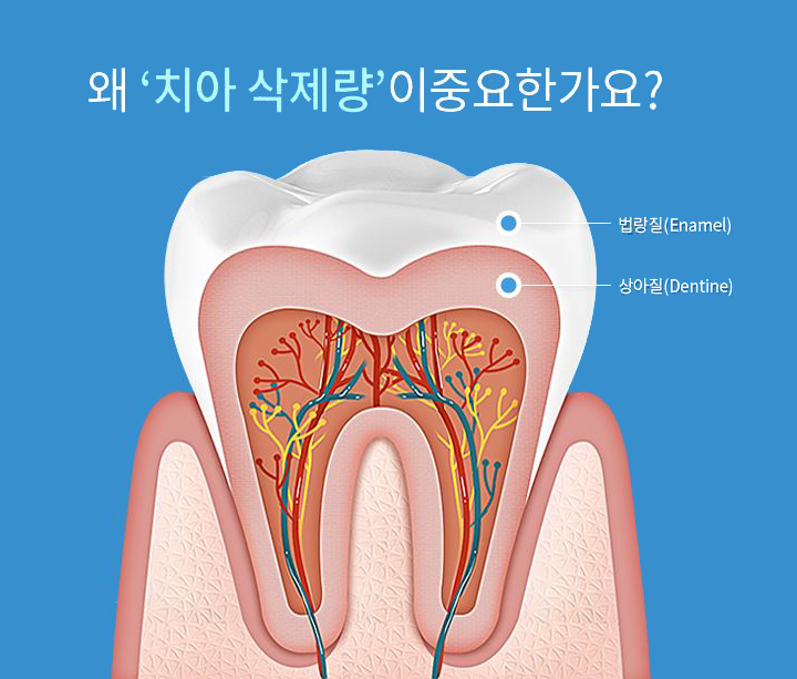 라미네이트비용 반짝효과 아닌 오래토록 예쁘게 관련 이미지 3