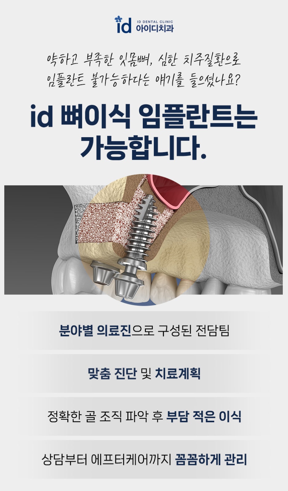 Recommended Place for Dental Implants That Reduces Fear image 15