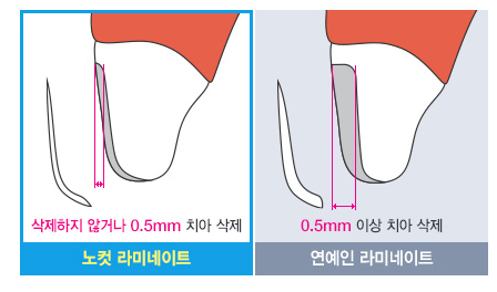 노컷라미네이트 삭제량이 적어 안심! 관련 이미지 3