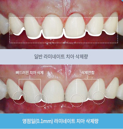 0.1라미 네이트 무리없이 깎아서 견고함을 높이다 관련 이미지 2
