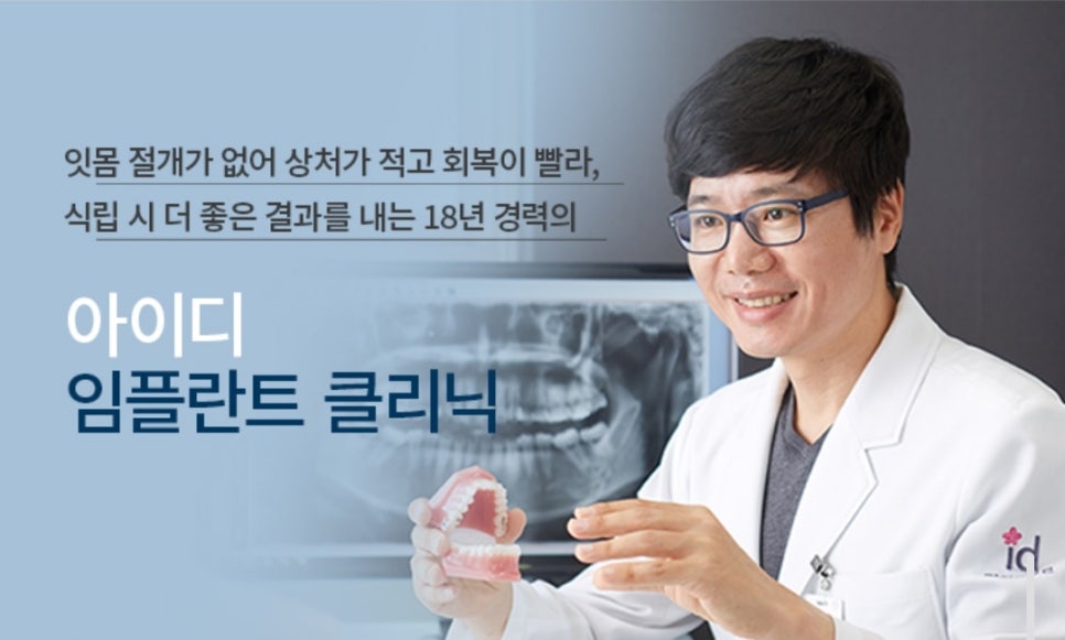 Molar Implants: Understanding Treatment Properly image 3