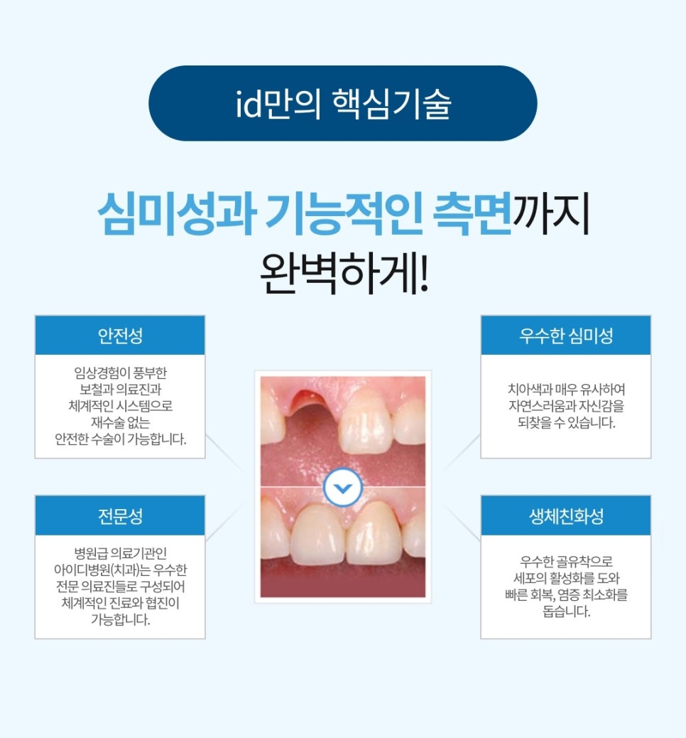 Bone Graft Implant Treatment – Supplementing Insufficient Alveolar Bone image 8