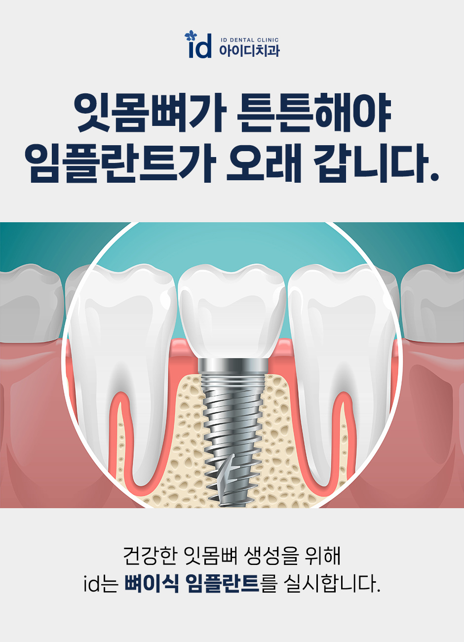 Why Bone Graft Implants Are Needed image 3