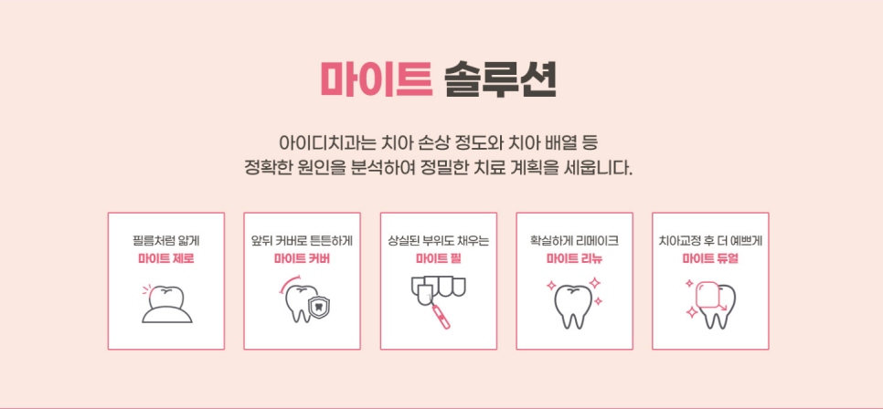 라미네이트 치료 전 알아두면 좋은 점 관련 이미지 4