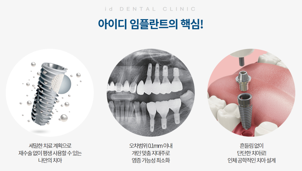 Implant Treatment: A Good Way to Replace Natural Teeth image 4