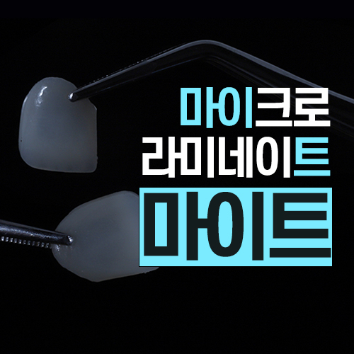 신사역라미네이트 잘하는 치과 핵심은 바로 이것 관련 이미지 1