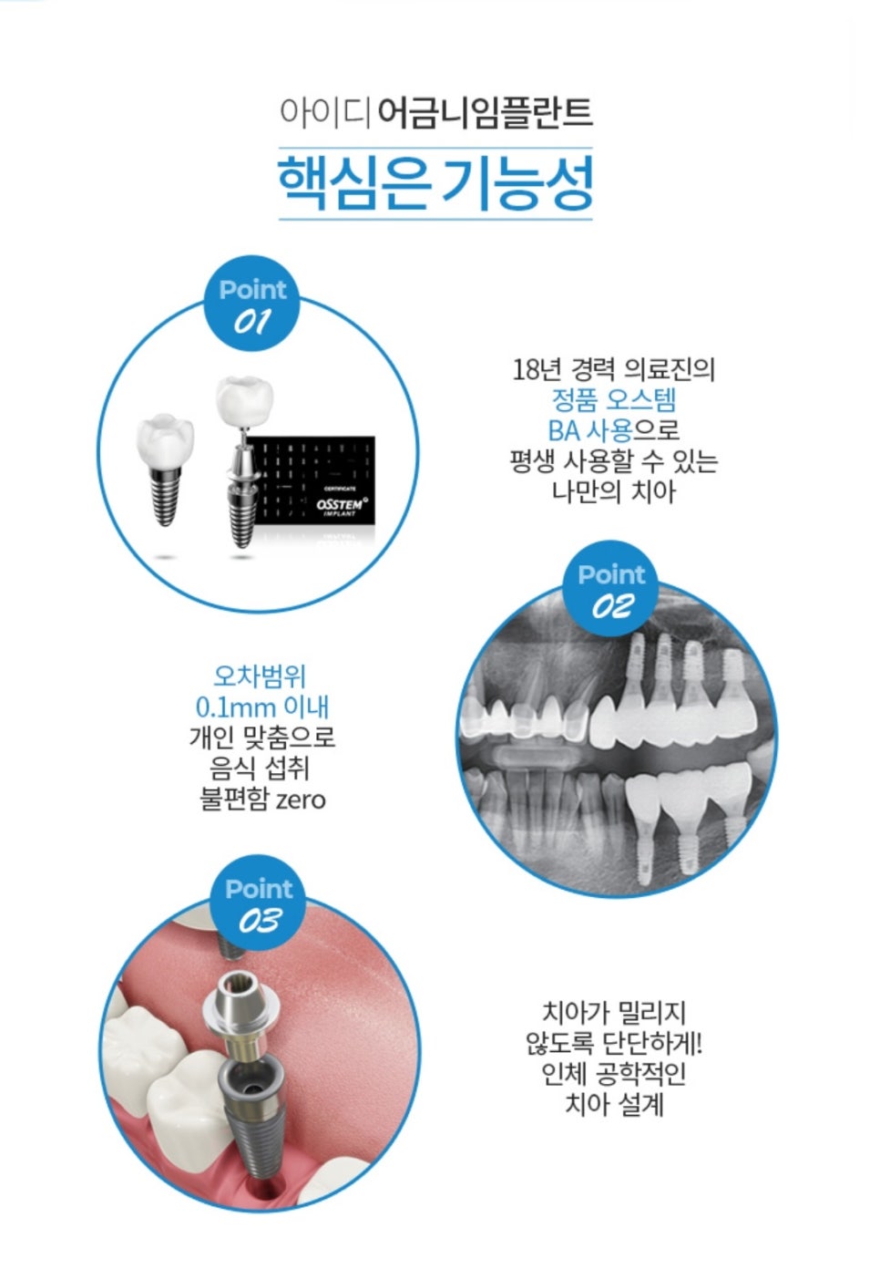 Molar Implants: Understanding Treatment Properly image 2