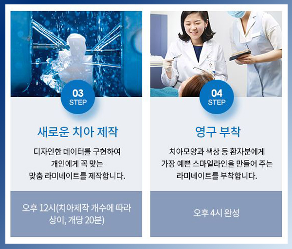 영점일 라미네이트 비용 만큼 중요한건 치아 삭제량! 관련 이미지 5