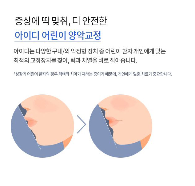어린이 부정교합 놓치지 않도록 조기부터 시작해야해 관련 이미지 4