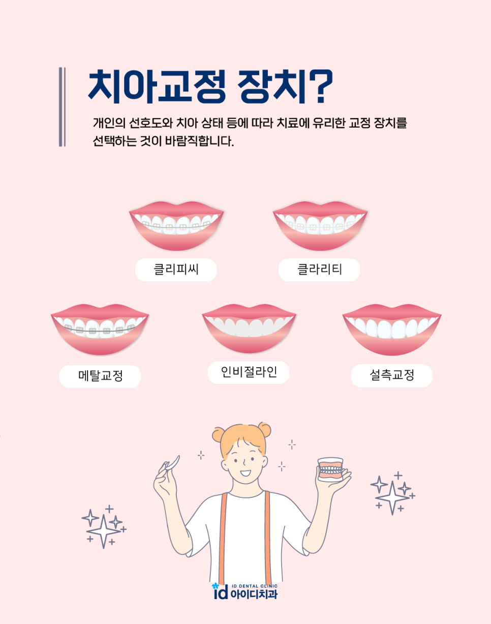 치아교정 장치 선택이 어렵다면? 관련 이미지 5