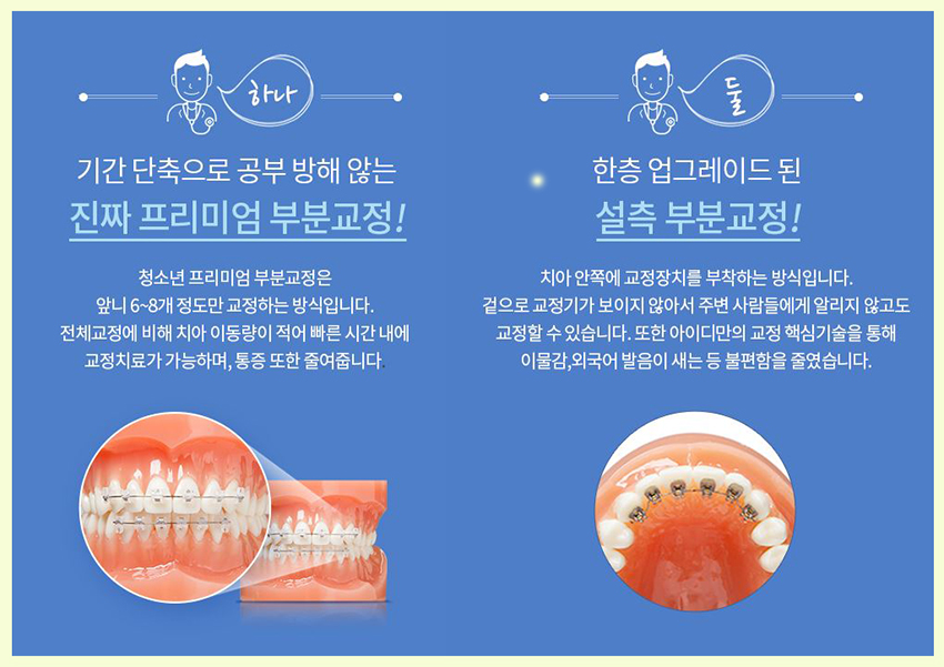 청소년치아교정 사춘기 치아고민 조기에 바로잡자 관련 이미지 6