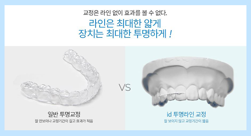 투명교정 부작용 해결을 도와줄 id 투명라인교정 관련 이미지 2
