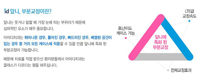 앞니부분교정후기 치아에 슬림하게 밀착되니 편해 관련 이미지 3