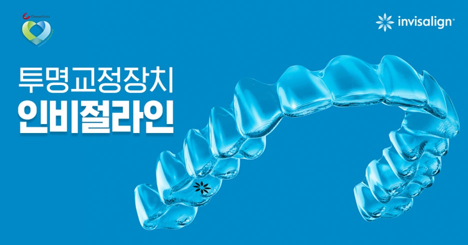 치아교정이 필요한 원인과 경우 관련 이미지 4