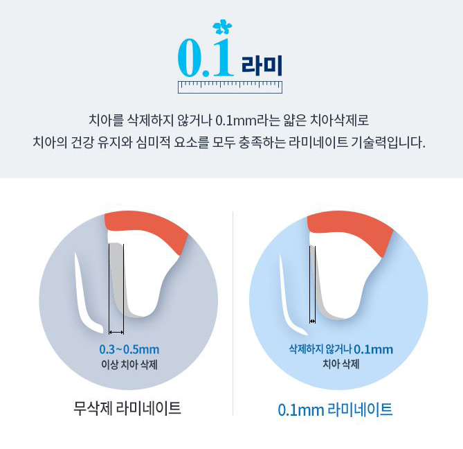 앞니라미네이트가격 만큼 슬림한 삭제량으로 관련 이미지 2