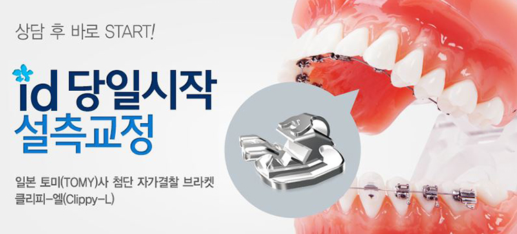 안보이는교정 아직도 감추고 다닐 걱정하세요? 관련 이미지 2