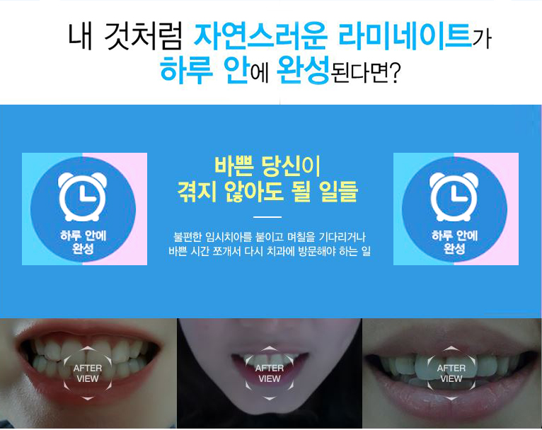 라미네이트 비용 싸다구!! 관련 이미지 2