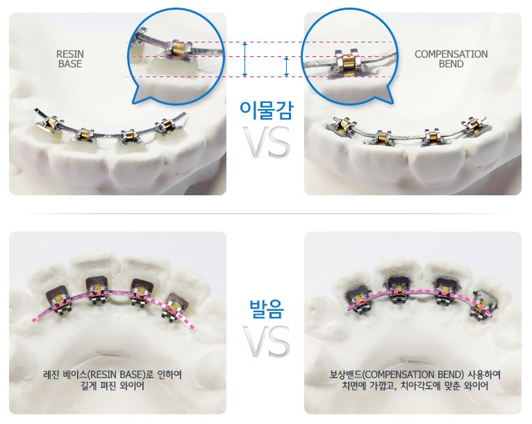 티안나는교정 안쪽으로 꼬옥 숨겨서 남모르게 관련 이미지 4