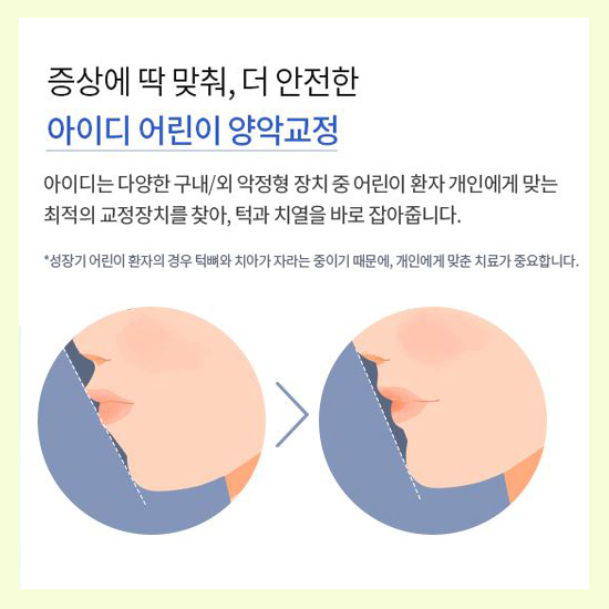 청소년교정 증상에 맞춘 다양한 방법으로 고민해결 관련 이미지 4