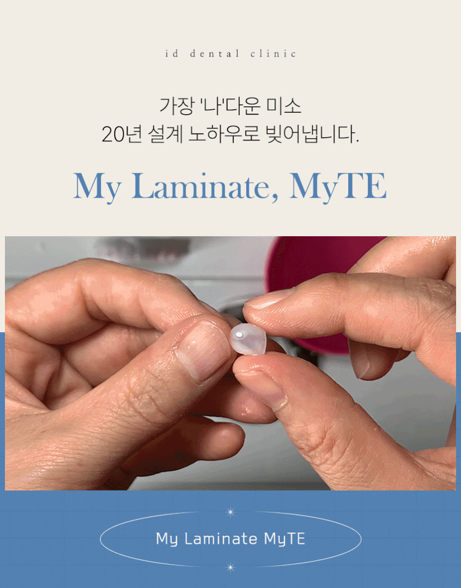 무삭제라미네이트 나에게 잘 어울리는 자연스러움 관련 이미지 16