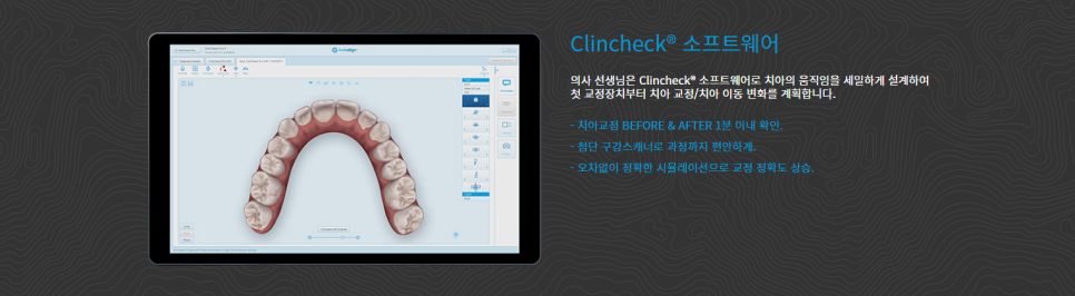 인비절라인, 기분좋은 미소를 위해! 관련 이미지 4