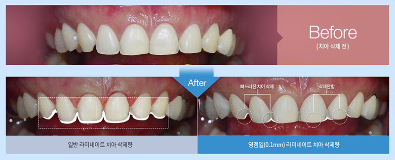 라미네이트비용 반짝효과 아닌 오래토록 예쁘게 관련 이미지 6