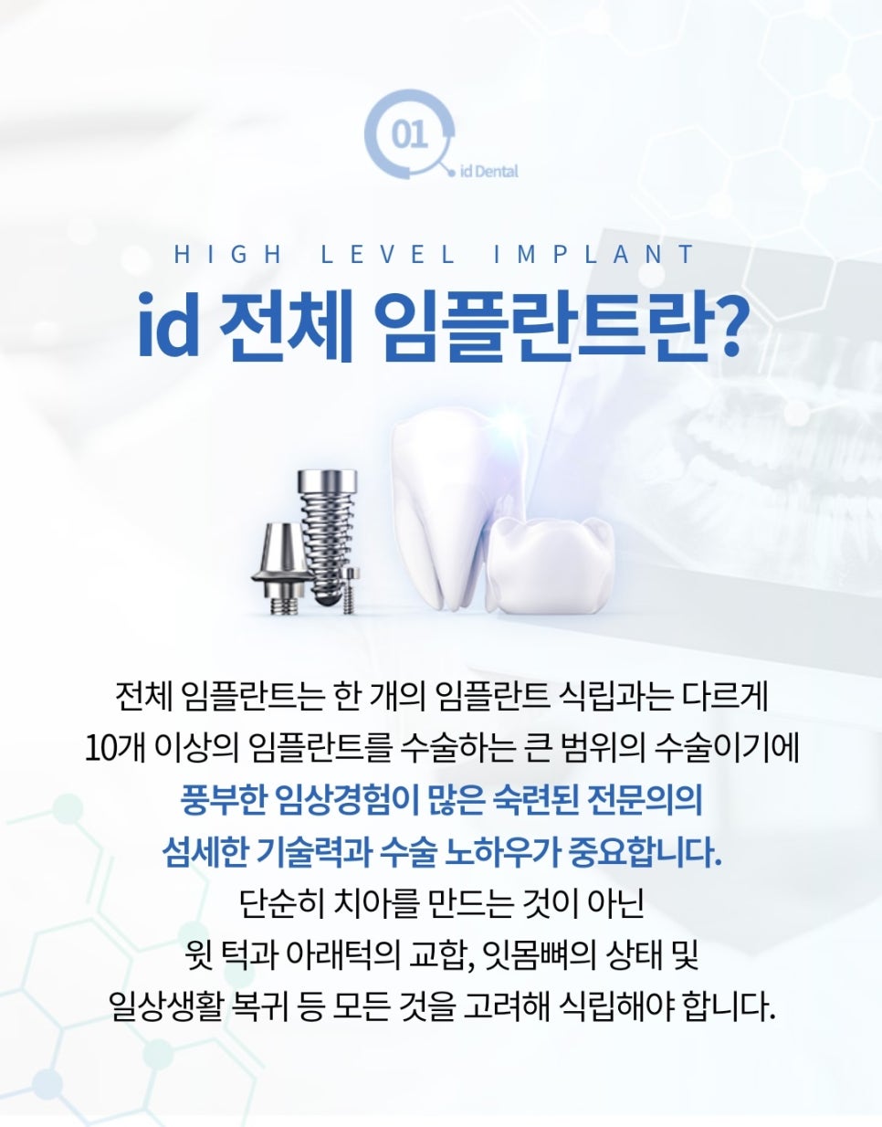 Full Mouth Implant Treatment: How to Regain a Natural Smile image 1