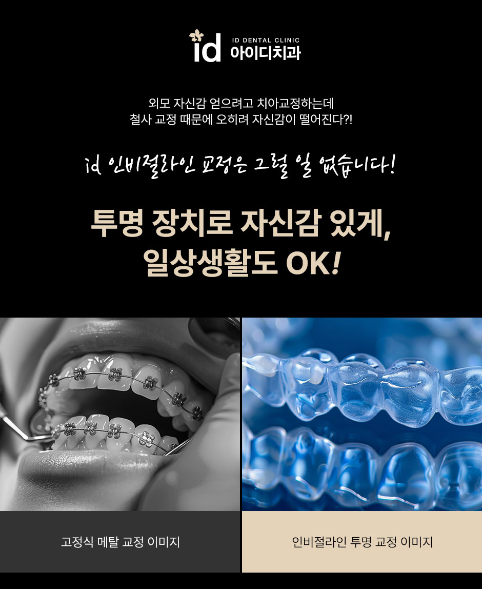 What Is Important When Getting Fast Front Teeth Orthodontic Treatment with Invisalign? image 1