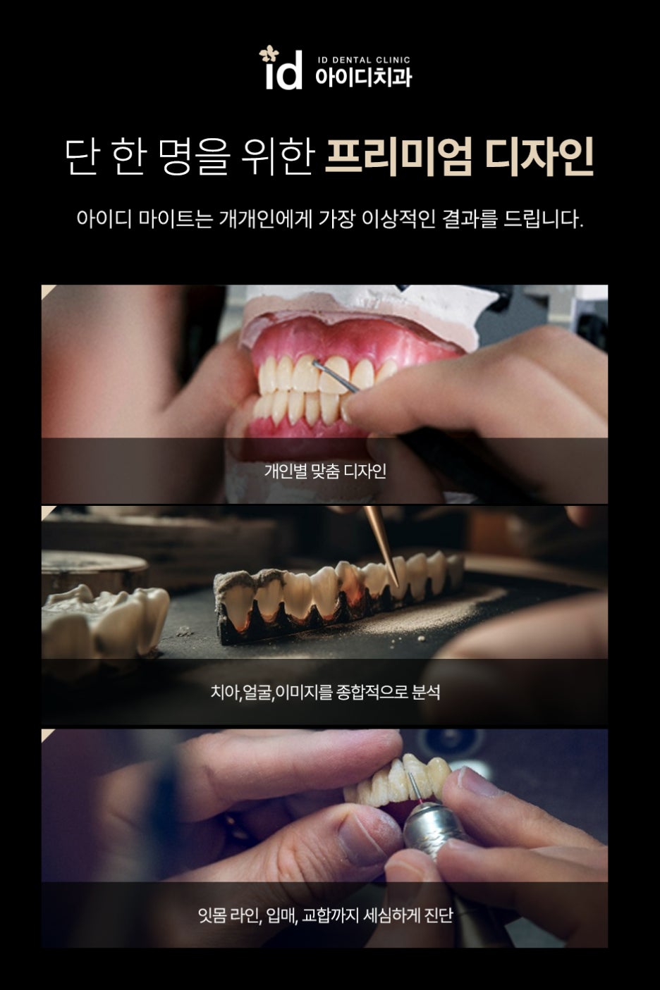What Should You Look At When Choosing No-Prep Laminate Veneers? image 4