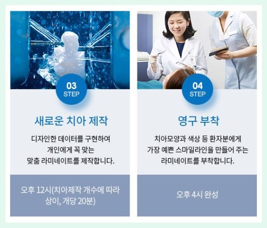 0.1라미네이트 무조건 깎지말고 지키세요~ 영점일 라미네이트 관련 이미지 3
