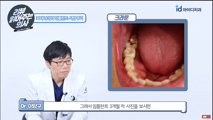 How to Easily Tell Which Places Are Good at Implants image 1