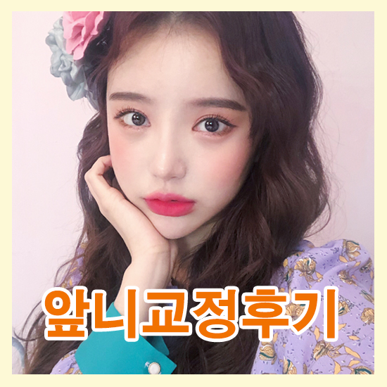 앞니교정후기 어떤 앞니고민도 다양하게 해결 관련 이미지 1