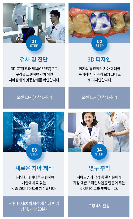 앞니라미네이트가격 만큼 슬림한 삭제량으로 관련 이미지 4