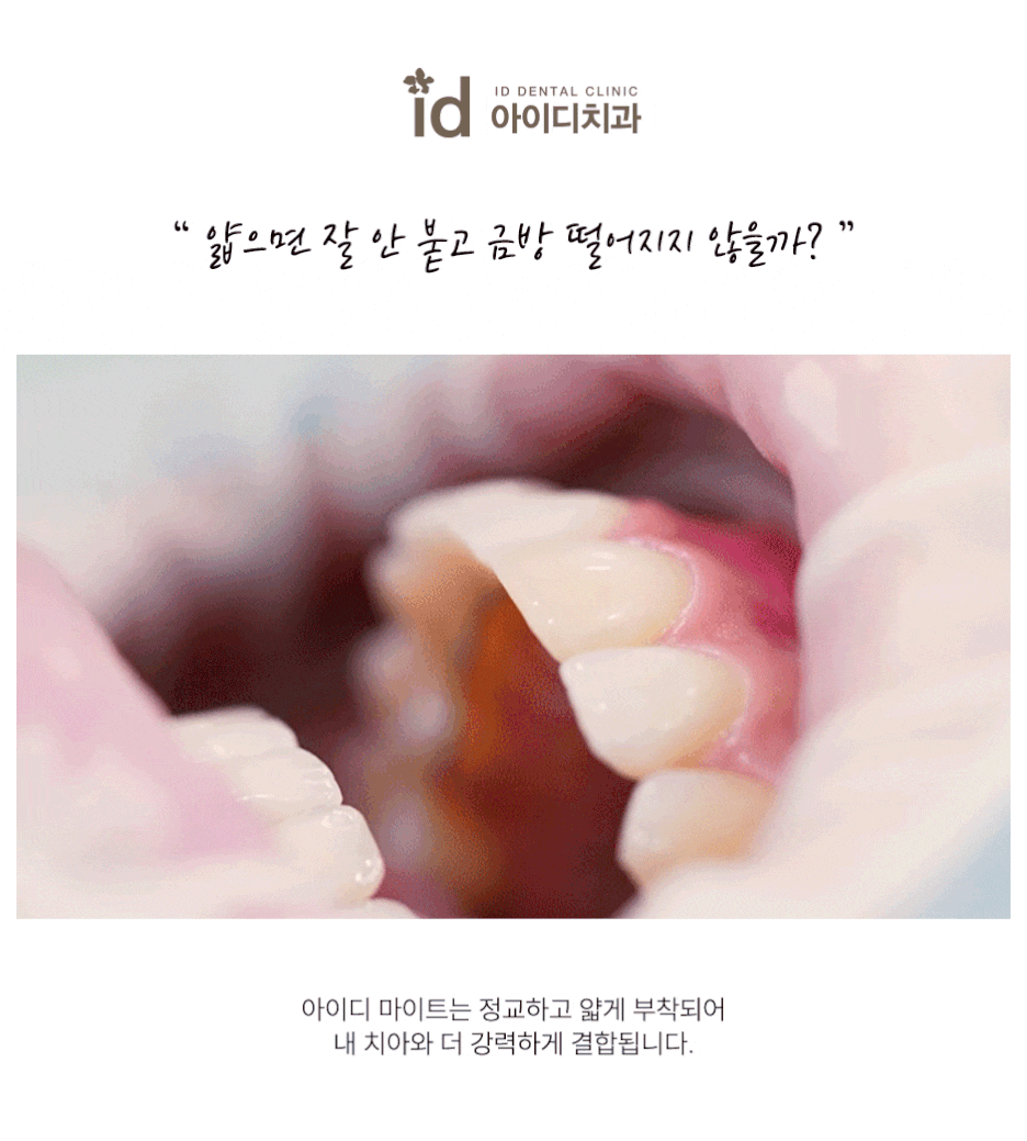 A Place That Considers the Health of Your Teeth for Veneers image 13