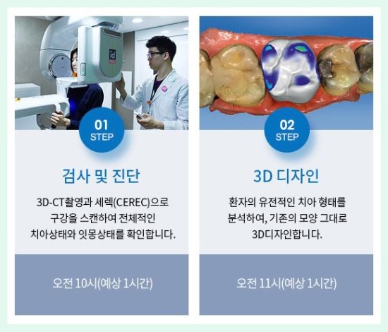 0.1라미네이트 무조건 깎지말고 지키세요~ 영점일 라미네이트 관련 이미지 4