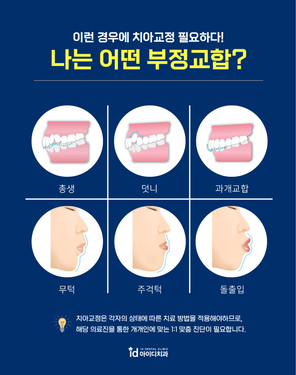 치아교정 장치 선택이 어렵다면? 관련 이미지 4